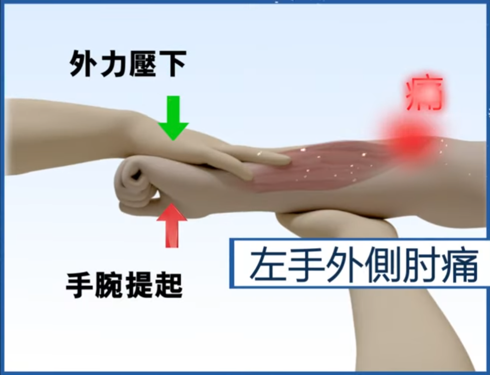 網球手
